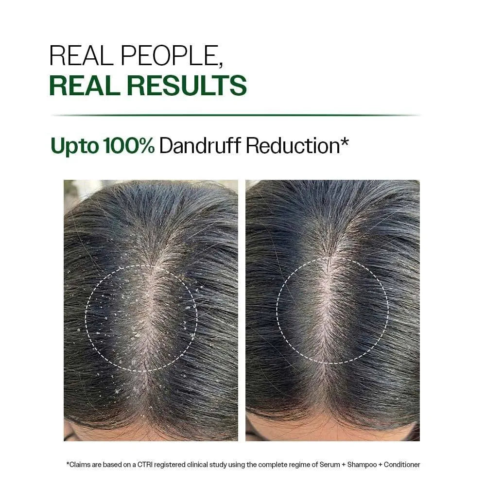 Pack of 2 Anti-Dandruff Shampoo | Up To 100% Dandruff Reduction | ZPTO-Free | pH 5.3 | Salicylic Acid, Piroctone Olamine &amp; Biotin | Non-Drying Formula | For Strong, Smooth Hair | Unisex&nbsp;